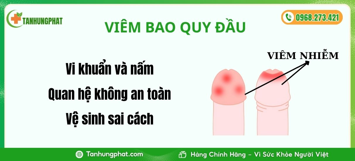 nguyên nhân gây bệnh nam khoa